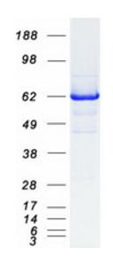 SDS-PAGE (RTKN-6216H).jpg